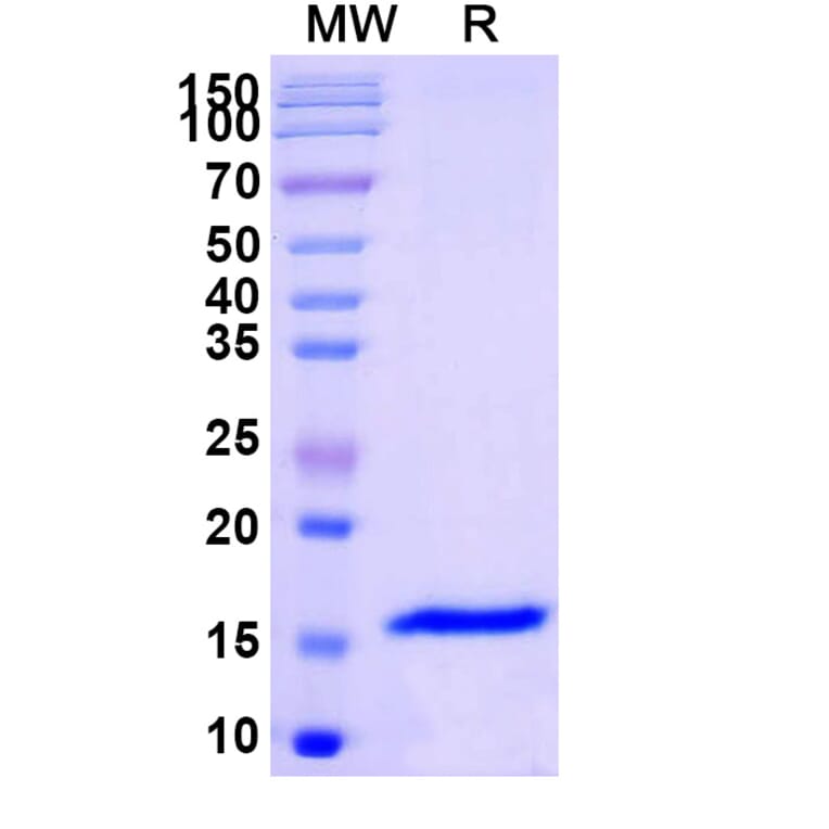 SDS-PAGE - Anti-SARS-CoV-2 Spike Protein Nanobody [SAA1109] (A338091) - Antibodies.com