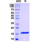SDS-PAGE - Anti-SARS-CoV-2 Spike Protein Nanobody [SAA1109] (A338091) - Antibodies.com