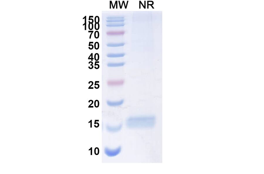 SDS-PAGE - Anti-SARS-CoV-2 Spike Protein Nanobody [SAA1111] (A338093) - Antibodies.com