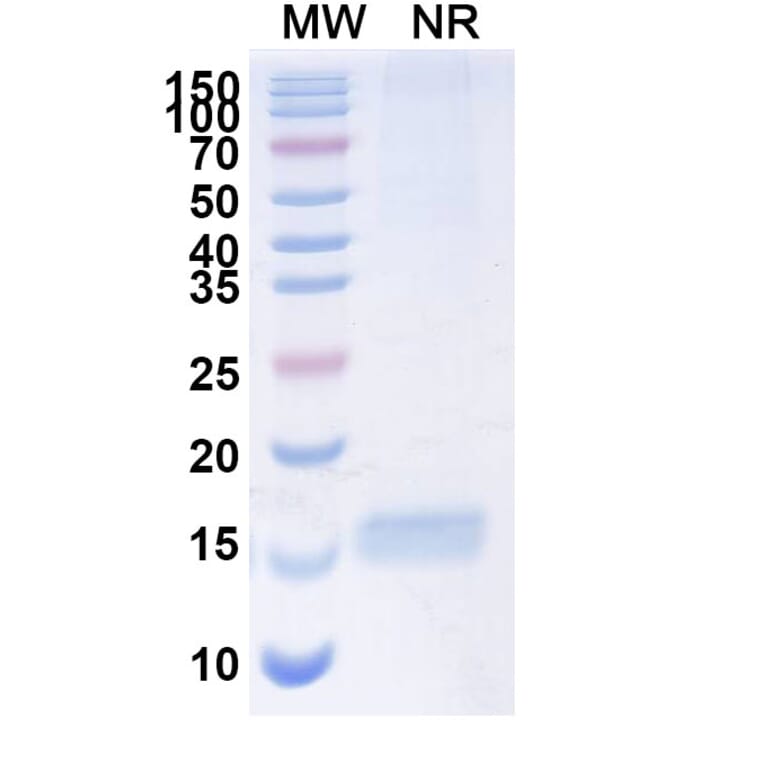 SDS-PAGE - Anti-SARS-CoV-2 Spike Protein Nanobody [SAA1111] (A338093) - Antibodies.com