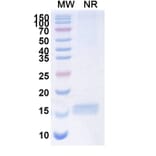SDS-PAGE - Anti-SARS-CoV-2 Spike Protein Nanobody [SAA1111] (A338093) - Antibodies.com