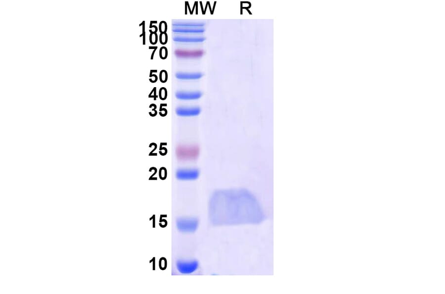 SDS-PAGE - Anti-SARS-CoV-2 Spike Protein Nanobody [SAA1114] (A338094) - Antibodies.com