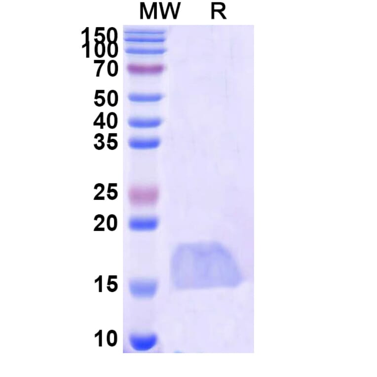 SDS-PAGE - Anti-SARS-CoV-2 Spike Protein Nanobody [SAA1114] (A338094) - Antibodies.com
