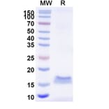 SDS-PAGE - Anti-SARS-CoV-2 Spike Protein Nanobody [SAA1118] (A338095) - Antibodies.com