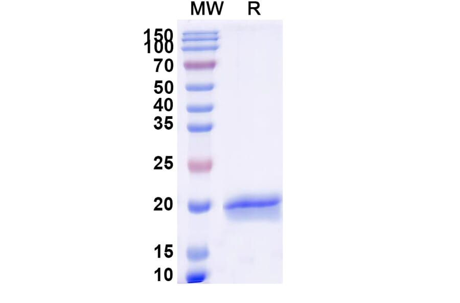 SDS-PAGE - Anti-SARS-CoV-2 Spike Protein Nanobody [SAA1121] (A338096) - Antibodies.com