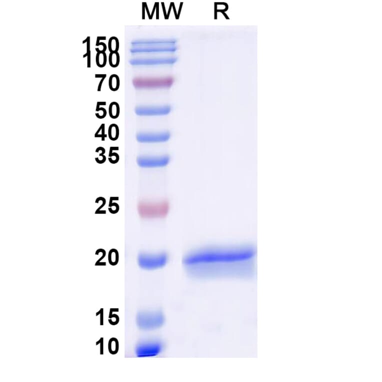 SDS-PAGE - Anti-SARS-CoV-2 Spike Protein Nanobody [SAA1121] (A338096) - Antibodies.com
