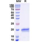 SDS-PAGE - Anti-SARS-CoV-2 Spike Protein Nanobody [SAA1121] (A338096) - Antibodies.com