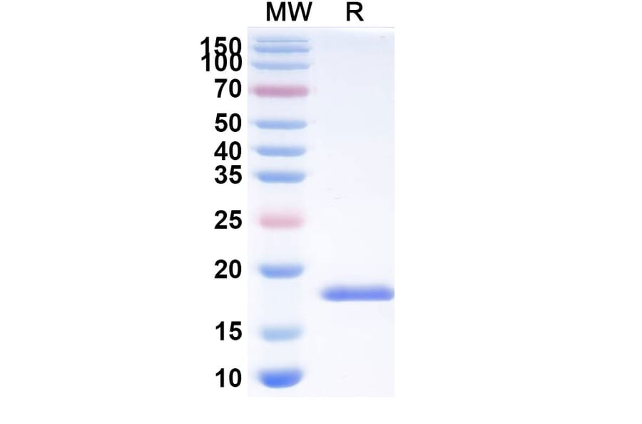 SDS-PAGE - Anti-SARS-CoV-2 Spike Protein Nanobody [SAA1122] (A338097) - Antibodies.com