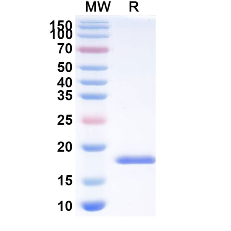 SDS-PAGE - Anti-SARS-CoV-2 Spike Protein Nanobody [SAA1122] (A338097) - Antibodies.com