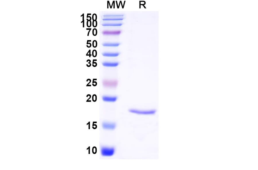 SDS-PAGE - Anti-SARS-CoV-2 Spike Protein Nanobody [SAA1123] (A338098) - Antibodies.com