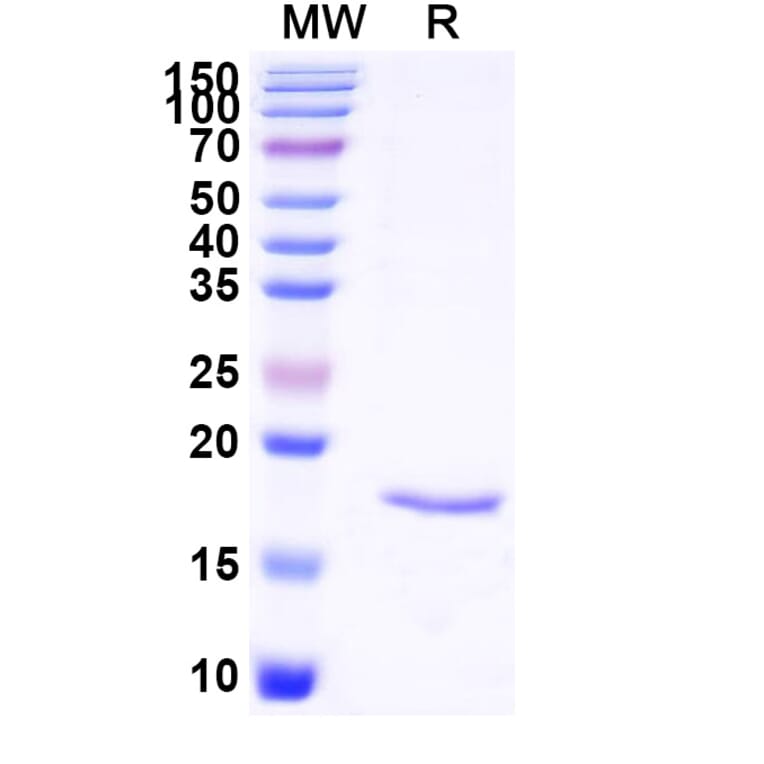 SDS-PAGE - Anti-SARS-CoV-2 Spike Protein Nanobody [SAA1123] (A338098) - Antibodies.com