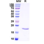 SDS-PAGE - Anti-SARS-CoV-2 Spike Protein Nanobody [SAA1123] (A338098) - Antibodies.com