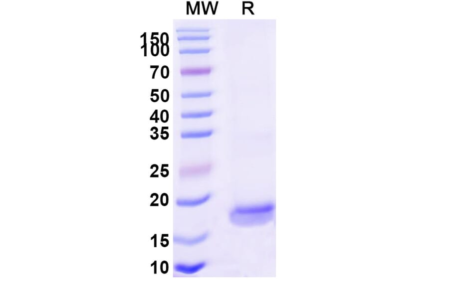 SDS-PAGE - Anti-SARS-CoV-2 Spike Protein Nanobody [SAA1124] (A338099) - Antibodies.com