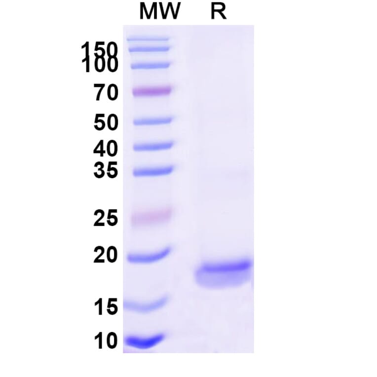 SDS-PAGE - Anti-SARS-CoV-2 Spike Protein Nanobody [SAA1124] (A338099) - Antibodies.com