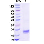 SDS-PAGE - Anti-SARS-CoV-2 Spike Protein Nanobody [SAA1124] (A338099) - Antibodies.com