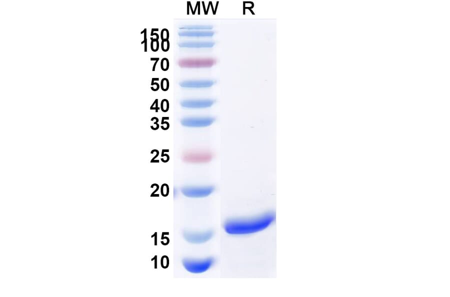 SDS-PAGE - Anti-SARS-CoV-2 Spike Protein Nanobody [SAA1147] (A338100) - Antibodies.com