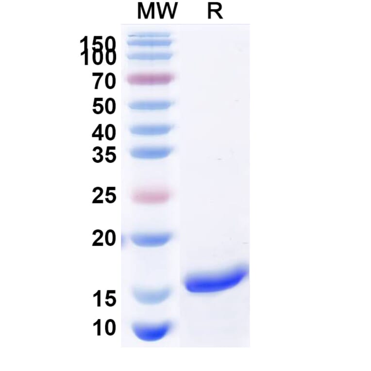 SDS-PAGE - Anti-SARS-CoV-2 Spike Protein Nanobody [SAA1147] (A338100) - Antibodies.com