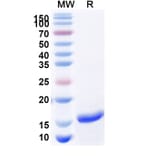 SDS-PAGE - Anti-SARS-CoV-2 Spike Protein Nanobody [SAA1147] (A338100) - Antibodies.com