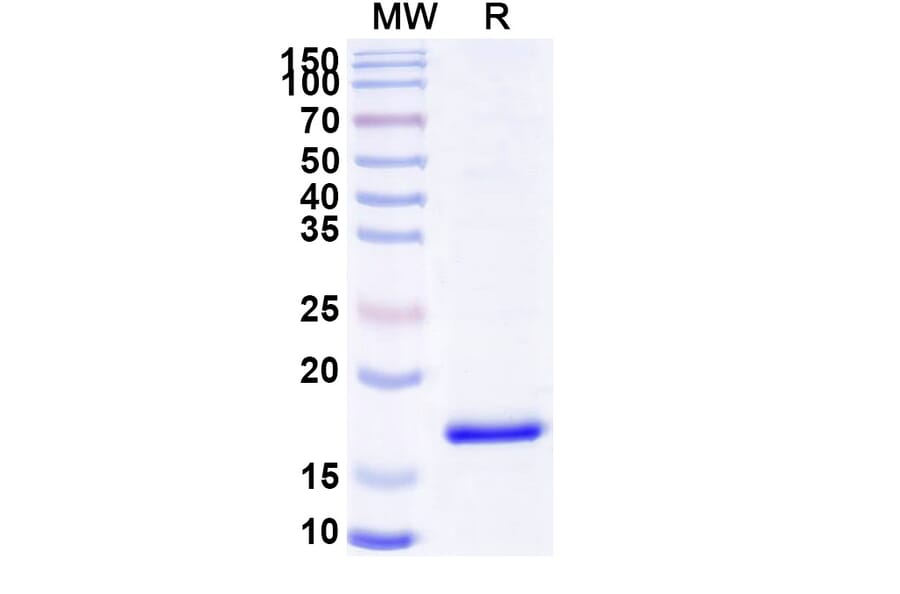 SDS-PAGE - Anti-Nucleoprotein Nanobody [SAA0960] (A338101) - Antibodies.com