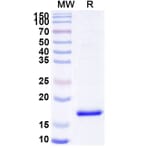 SDS-PAGE - Anti-Nucleoprotein Nanobody [SAA0960] (A338101) - Antibodies.com