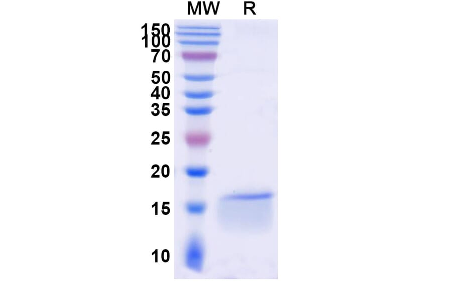 SDS-PAGE - Anti-Nucleoprotein Nanobody [SAA0961] (A338102) - Antibodies.com