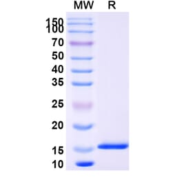 SDS-PAGE - Anti-Nucleoprotein Nanobody [SAA1347] (A338103) - Antibodies.com