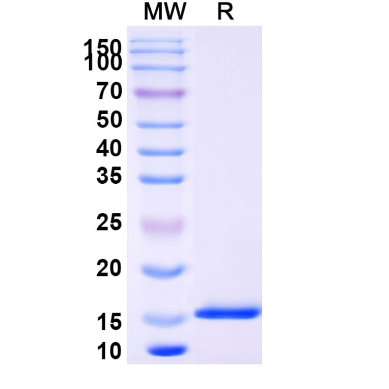 SDS-PAGE - Anti-Nucleoprotein Nanobody [SAA1347] (A338103) - Antibodies.com