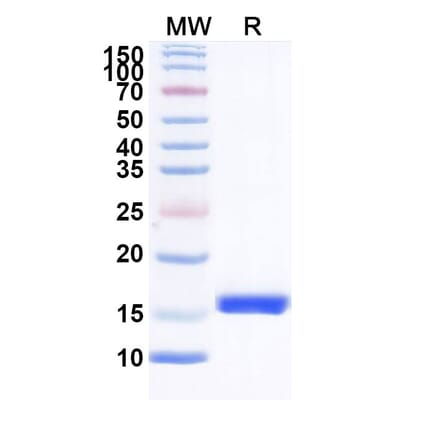SDS-PAGE - Anti-ITIH4 Nanobody [SAA0912] (A338108) - Antibodies.com