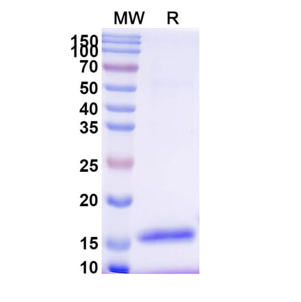 SDS-PAGE - Anti-ITIH4 Nanobody [SAA0881] (A338109) - Antibodies.com