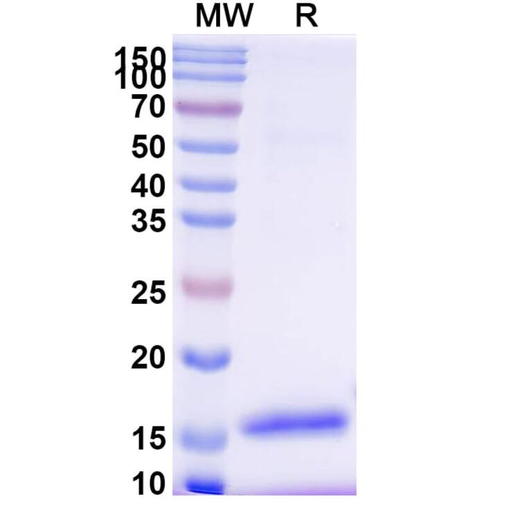 SDS-PAGE - Anti-ITIH4 Nanobody [SAA0881] (A338109) - Antibodies.com