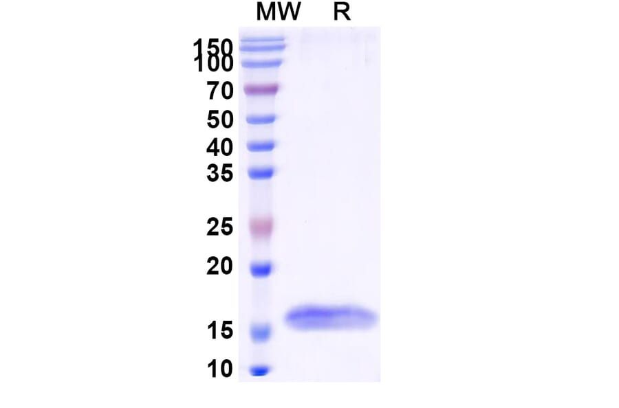 SDS-PAGE - Anti-ITIH4 Nanobody [SAA0882] (A338110) - Antibodies.com