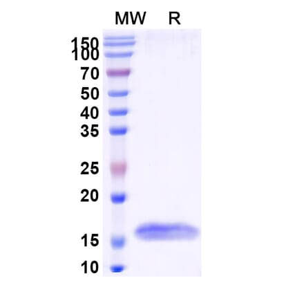 SDS-PAGE - Anti-ITIH4 Nanobody [SAA0882] (A338110) - Antibodies.com