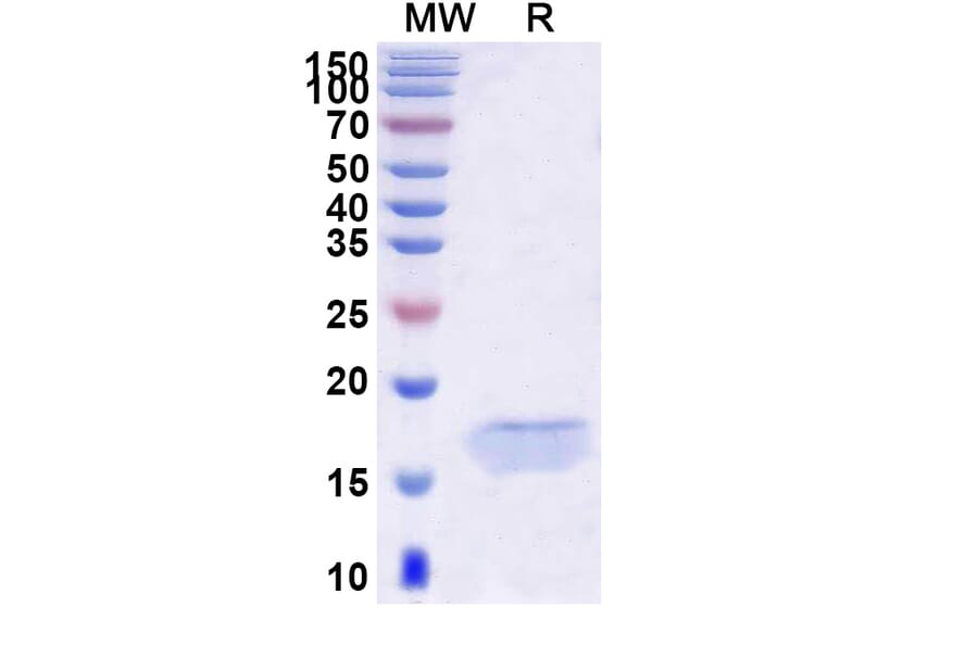 SDS-PAGE - Anti-ITIH4 Nanobody [SAA0894] (A338112) - Antibodies.com