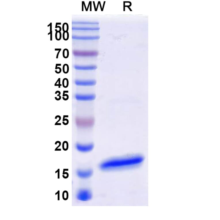 SDS-PAGE - Anti-SARS-CoV-2 Spike Protein Nanobody [SAA1322] (A338120) - Antibodies.com