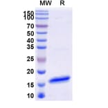 SDS-PAGE - Anti-SARS-CoV-2 Spike Protein Nanobody [SAA1322] (A338120) - Antibodies.com