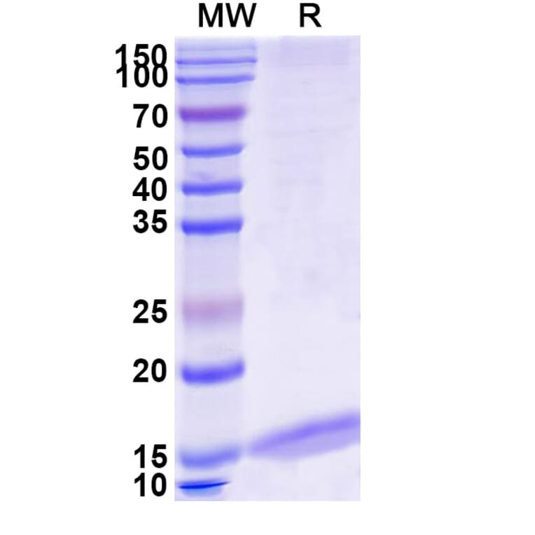 SDS-PAGE - Anti-SARS-CoV-2 Spike Protein Nanobody [SAA1009] (A338121) - Antibodies.com