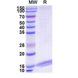 SDS-PAGE - Anti-SARS-CoV-2 Spike Protein Nanobody [SAA1009] (A338121) - Antibodies.com