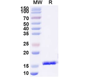 SDS-PAGE - Anti-Gag Polyprotein Nanobody [SAA0890] (A338123) - Antibodies.com