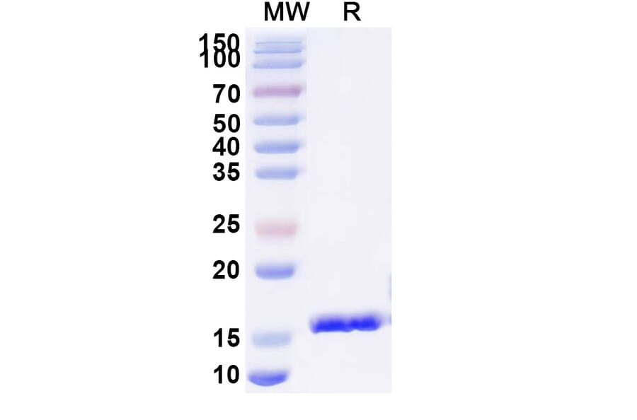 SDS-PAGE - Anti-Gag Polyprotein Nanobody [SAA0890] (A338123) - Antibodies.com