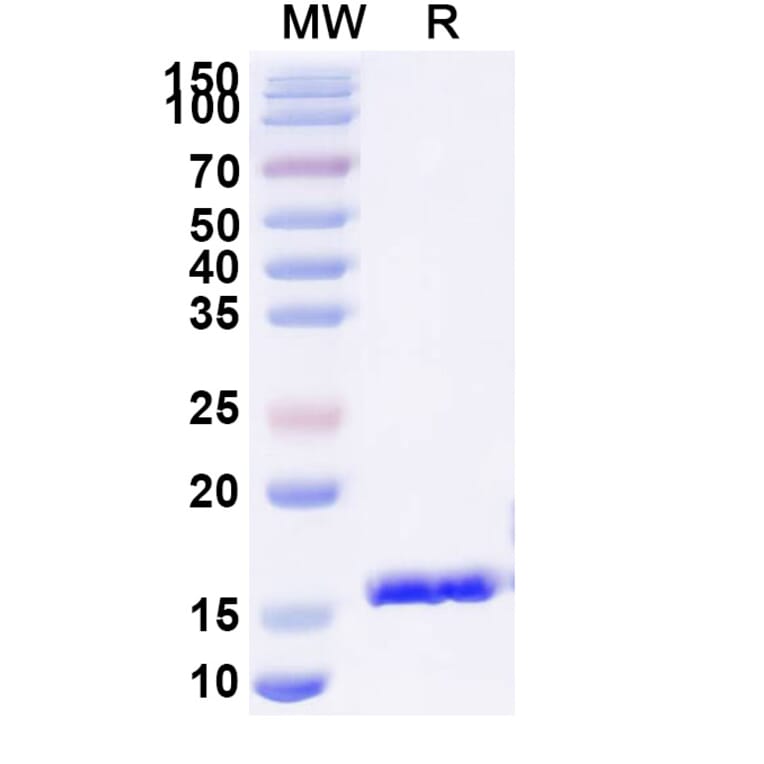 SDS-PAGE - Anti-Gag Polyprotein Nanobody [SAA0890] (A338123) - Antibodies.com