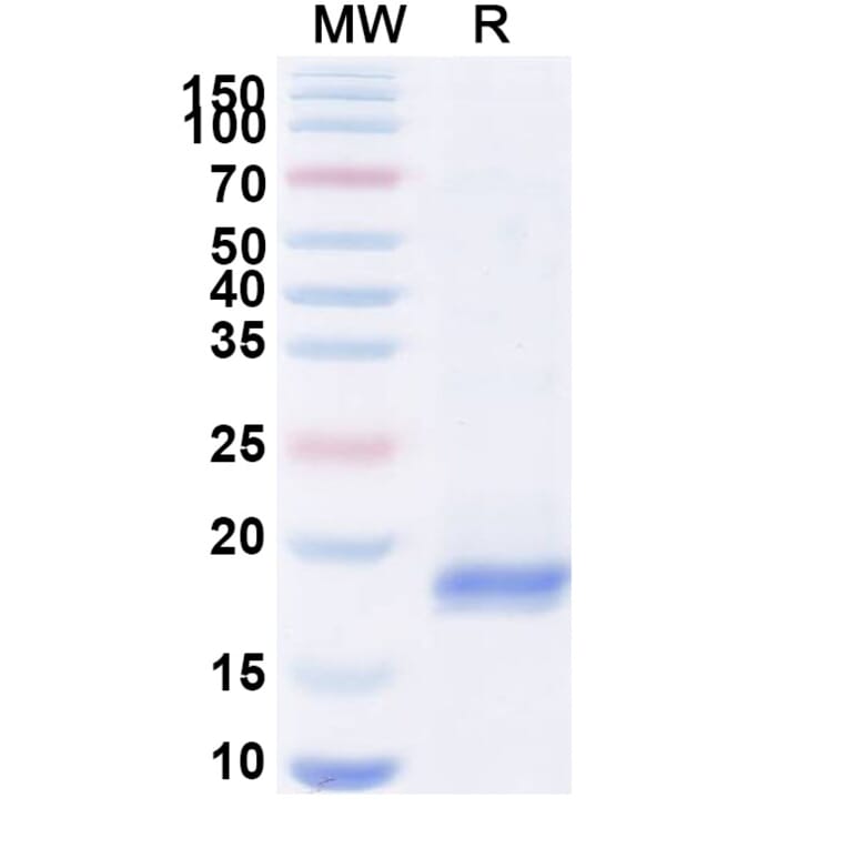 SDS-PAGE - Anti-Gag Polyprotein Nanobody [SAA0891] (A338124) - Antibodies.com