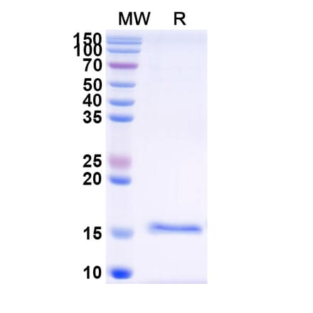 SDS-PAGE - Anti-NUP54 Nanobody [SAA1183] (A338128) - Antibodies.com