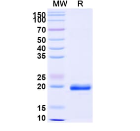 SDS-PAGE - Anti-NUP54 Nanobody [SAA0873] (A338129) - Antibodies.com