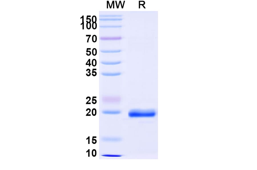 SDS-PAGE - Anti-NUP54 Nanobody [SAA0873] (A338129) - Antibodies.com