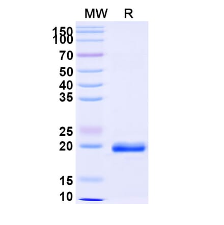SDS-PAGE - Anti-NUP54 Nanobody [SAA0873] (A338129) - Antibodies.com