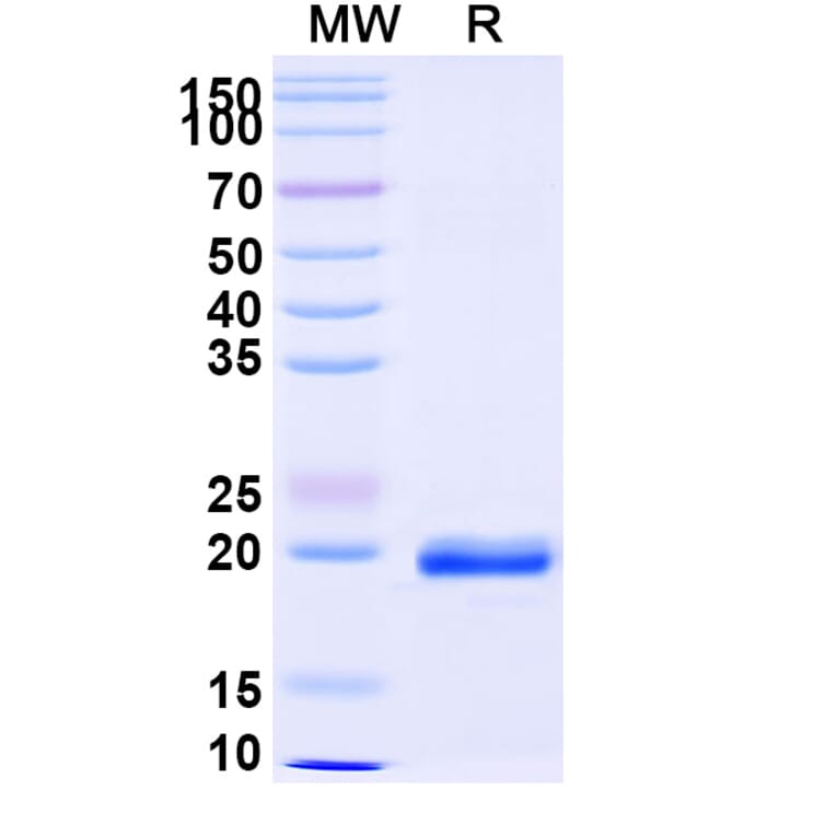 SDS-PAGE - Anti-NUP54 Nanobody [SAA0873] (A338129) - Antibodies.com