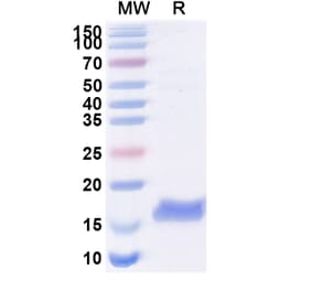 SDS-PAGE - Anti-Thioredoxin Nanobody [SAA1139] (A338153) - Antibodies.com