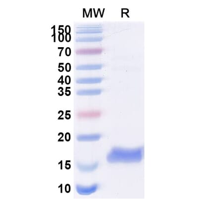 SDS-PAGE - Anti-Thioredoxin Nanobody [SAA1139] (A338153) - Antibodies.com