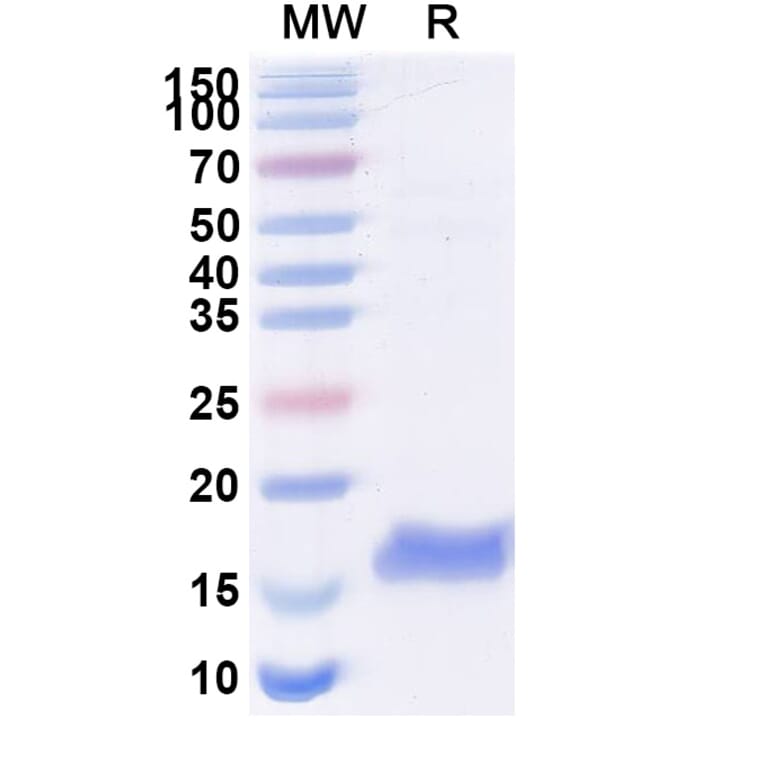 SDS-PAGE - Anti-Thioredoxin Nanobody [SAA1139] (A338153) - Antibodies.com