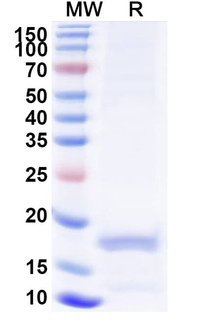 Recombinant Anti-porM Nanobody [SAA0959] (A338156) | Antibodies.com